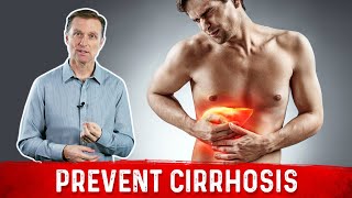 Best Herbs for Liver Cirrhosis [upl. by Yrro876]