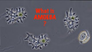 What is Amoeba [upl. by Airemahs]