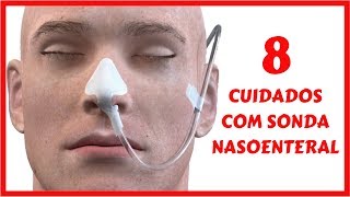 Cuidados de Enfermagem com Sonda Nasoenteral [upl. by Erbas]