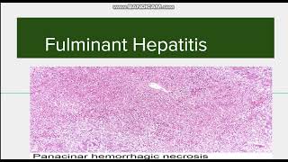 Fulminant Hepatitis Introduction Causes and Morphology [upl. by Deeann]