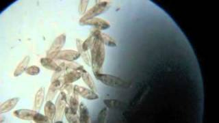 Paramecium Under the Microscope [upl. by Rellia]